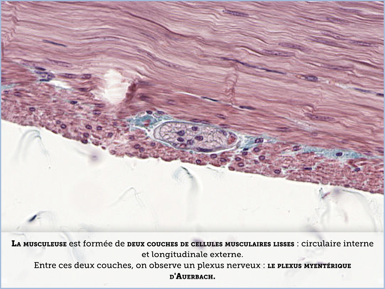 FICHE 2 TUMEUR WARTHIN ECRAN A