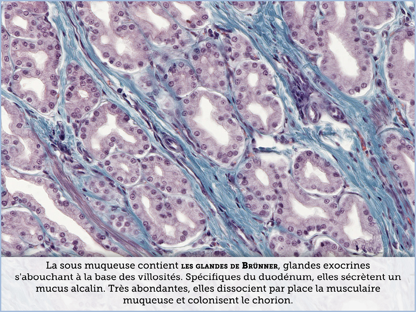 FICHE 2 TUMEUR WARTHIN ECRAN B