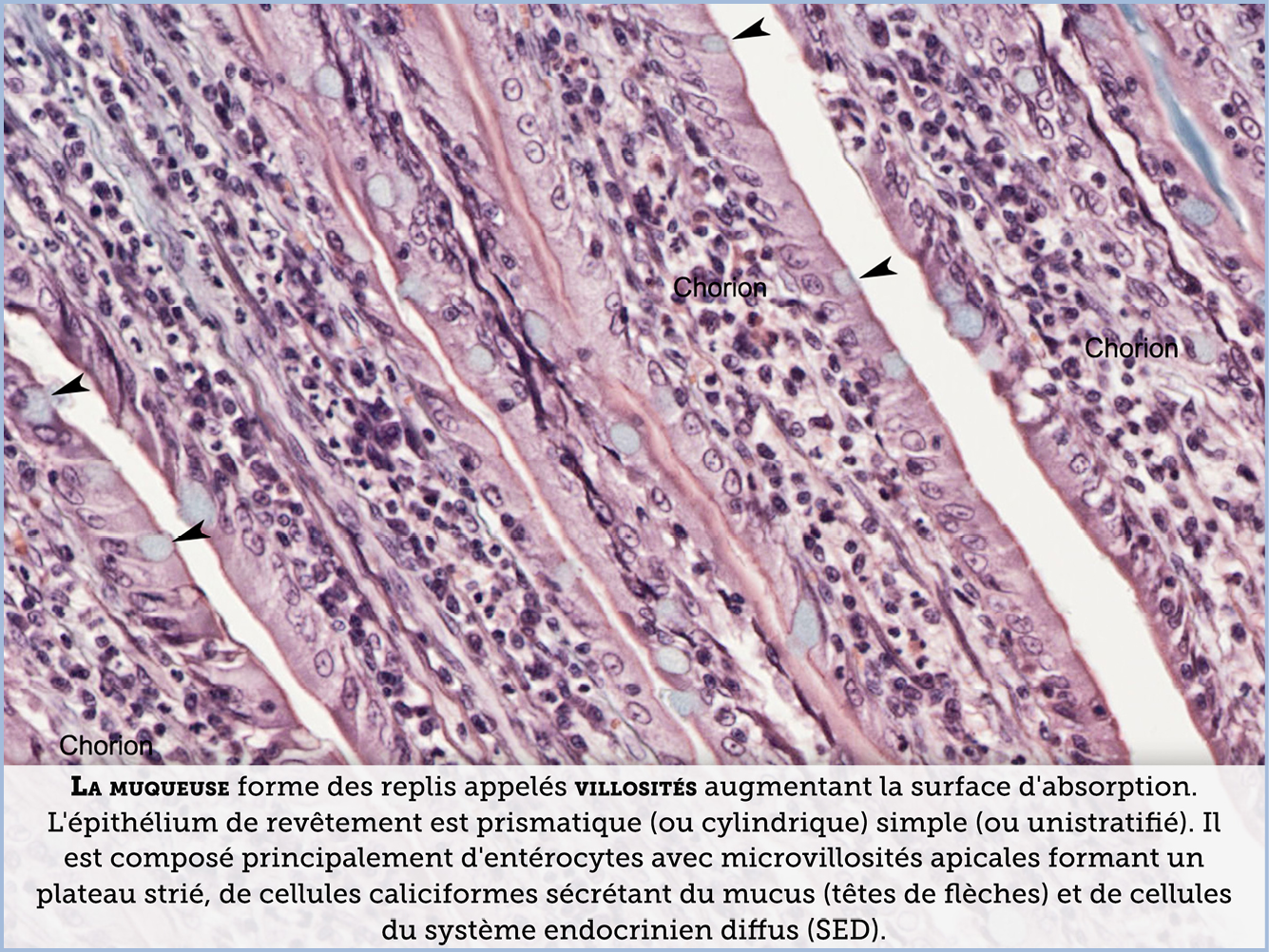 FICHE 2 TUMEUR WARTHIN VIDEO