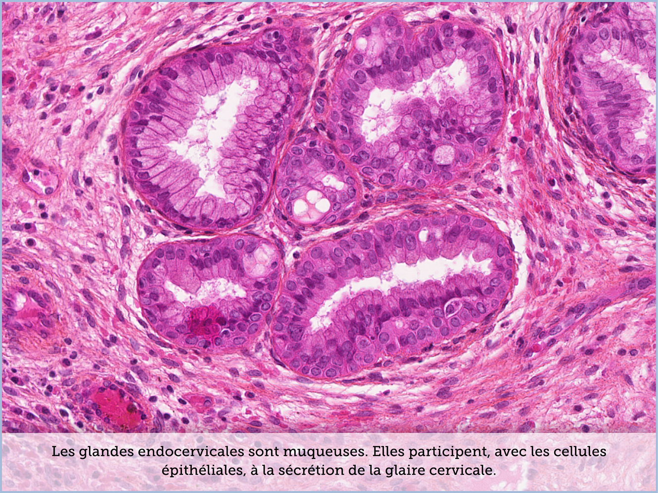 FICHE 2 TUMEUR WARTHIN ECRAN A