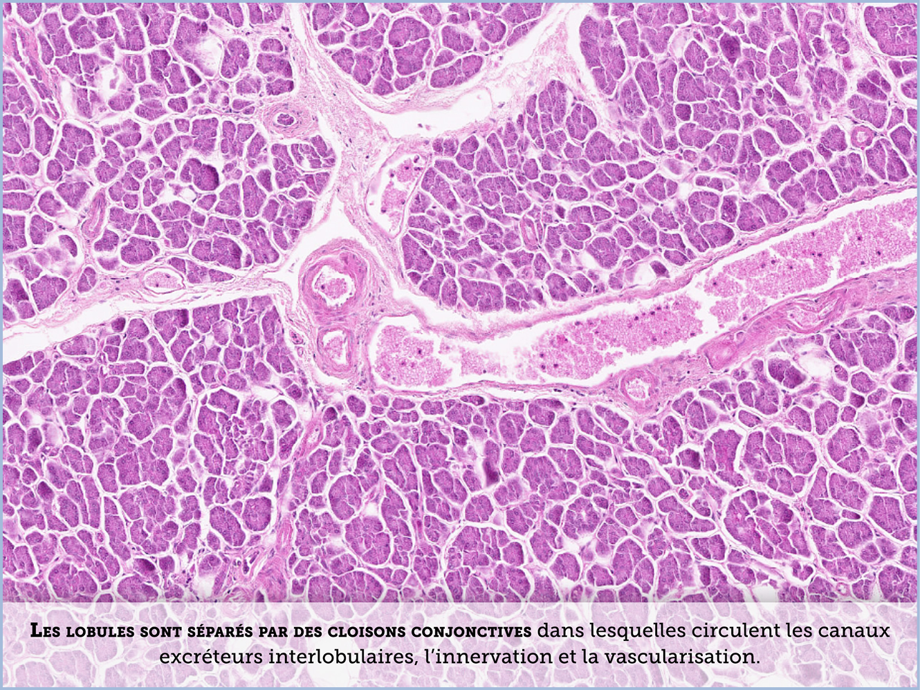 FICHE 2 TUMEUR WARTHIN ECRAN B