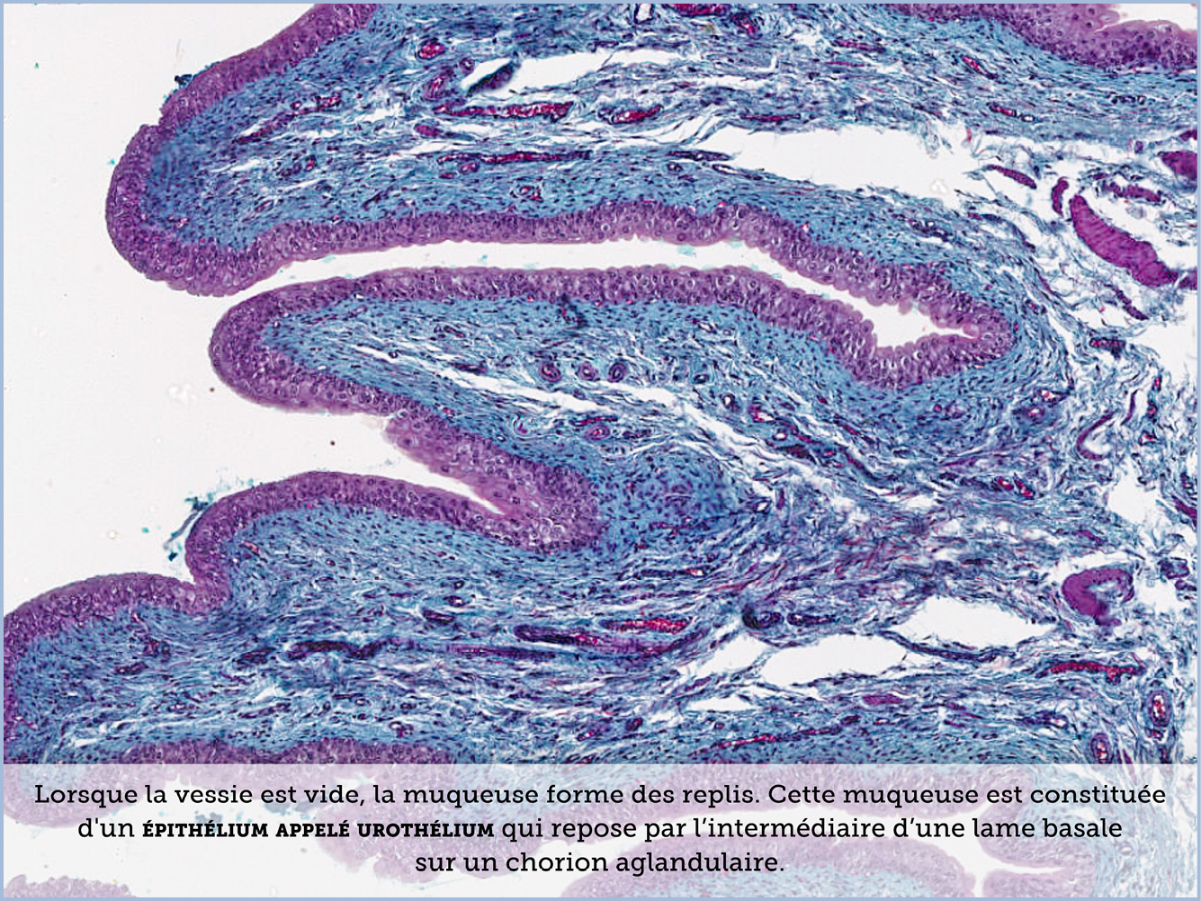 FICHE 2 TUMEUR WARTHIN VIDEO