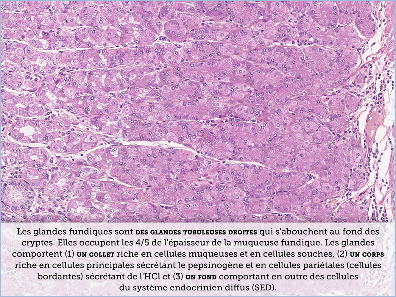 FICHE 2 TUMEUR WARTHIN ECRAN C