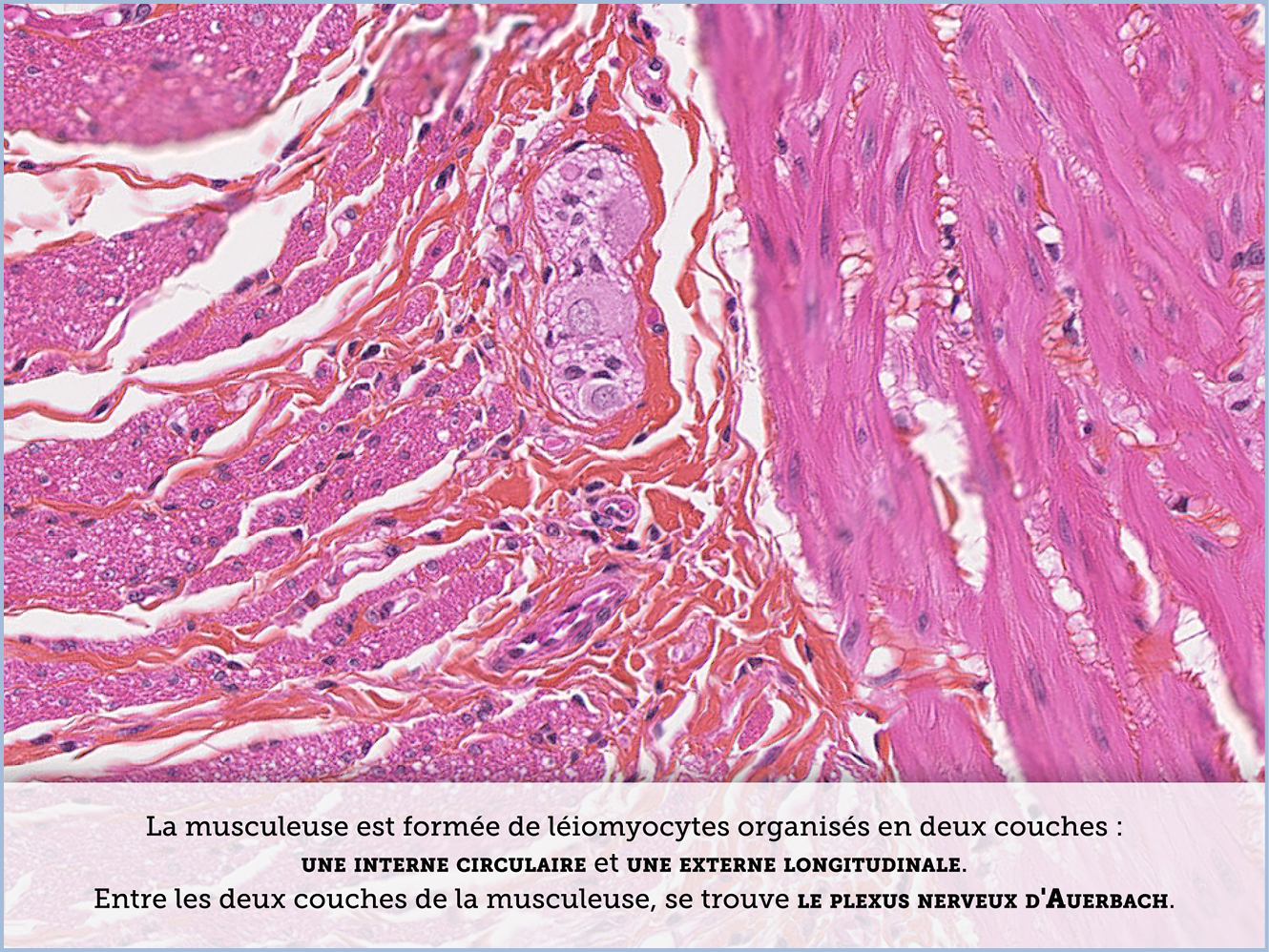 FICHE 2 TUMEUR WARTHIN ECRAN A