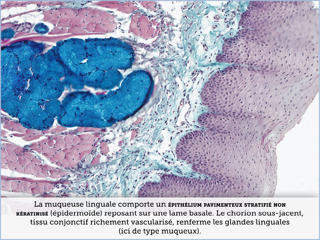 FICHE 2 TUMEUR WARTHIN VIDEO