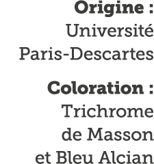 Origine : Universit  Paris-Descartes Coloration : Trichrome de Masson et Bleu Alcian