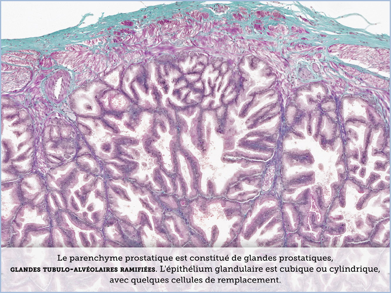 FICHE 2 TUMEUR WARTHIN VIDEO