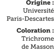 Origine : Universit  Paris-Descartes Coloration : Trichrome de Masson