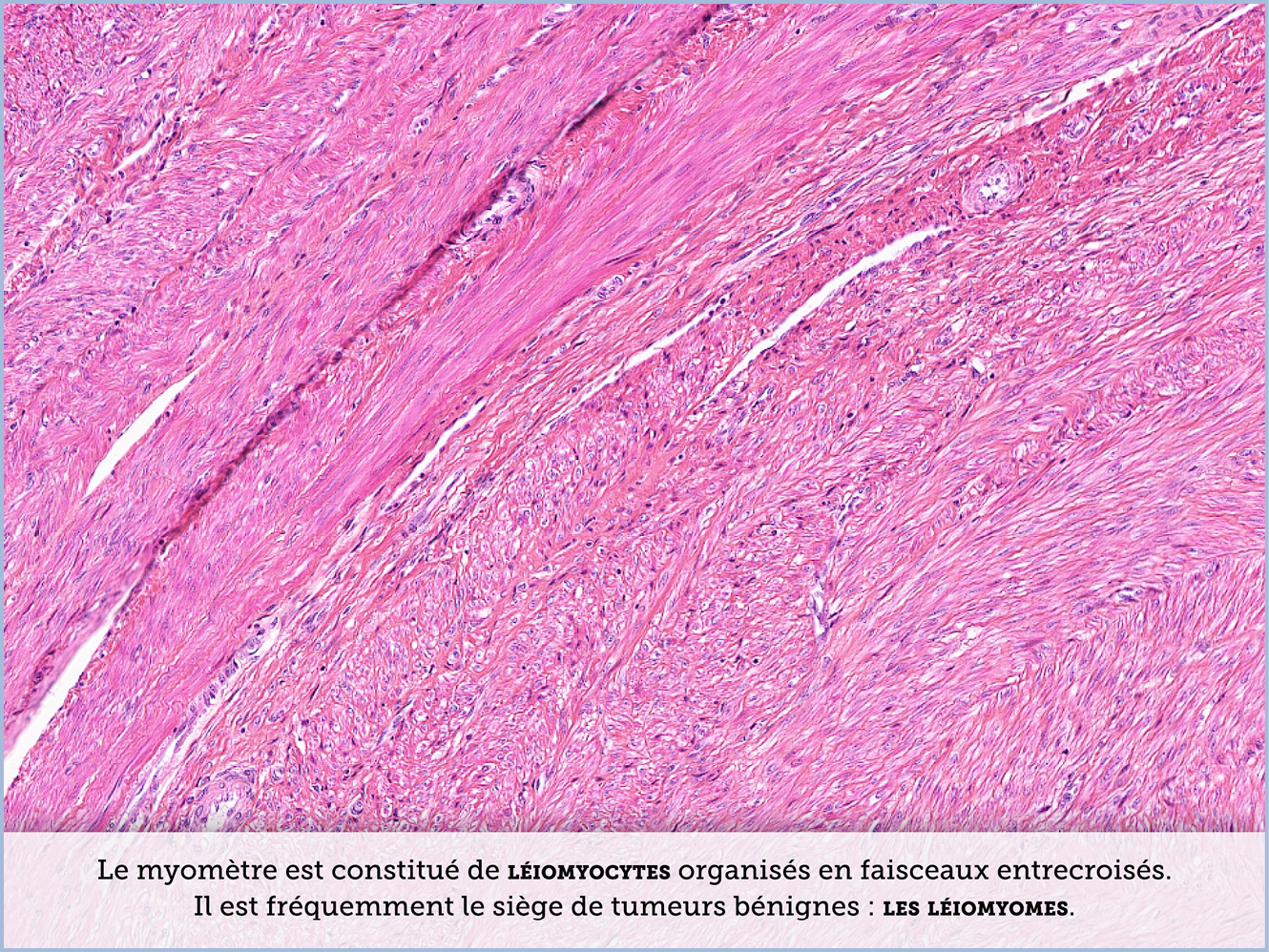 FICHE 2 TUMEUR WARTHIN ECRAN B