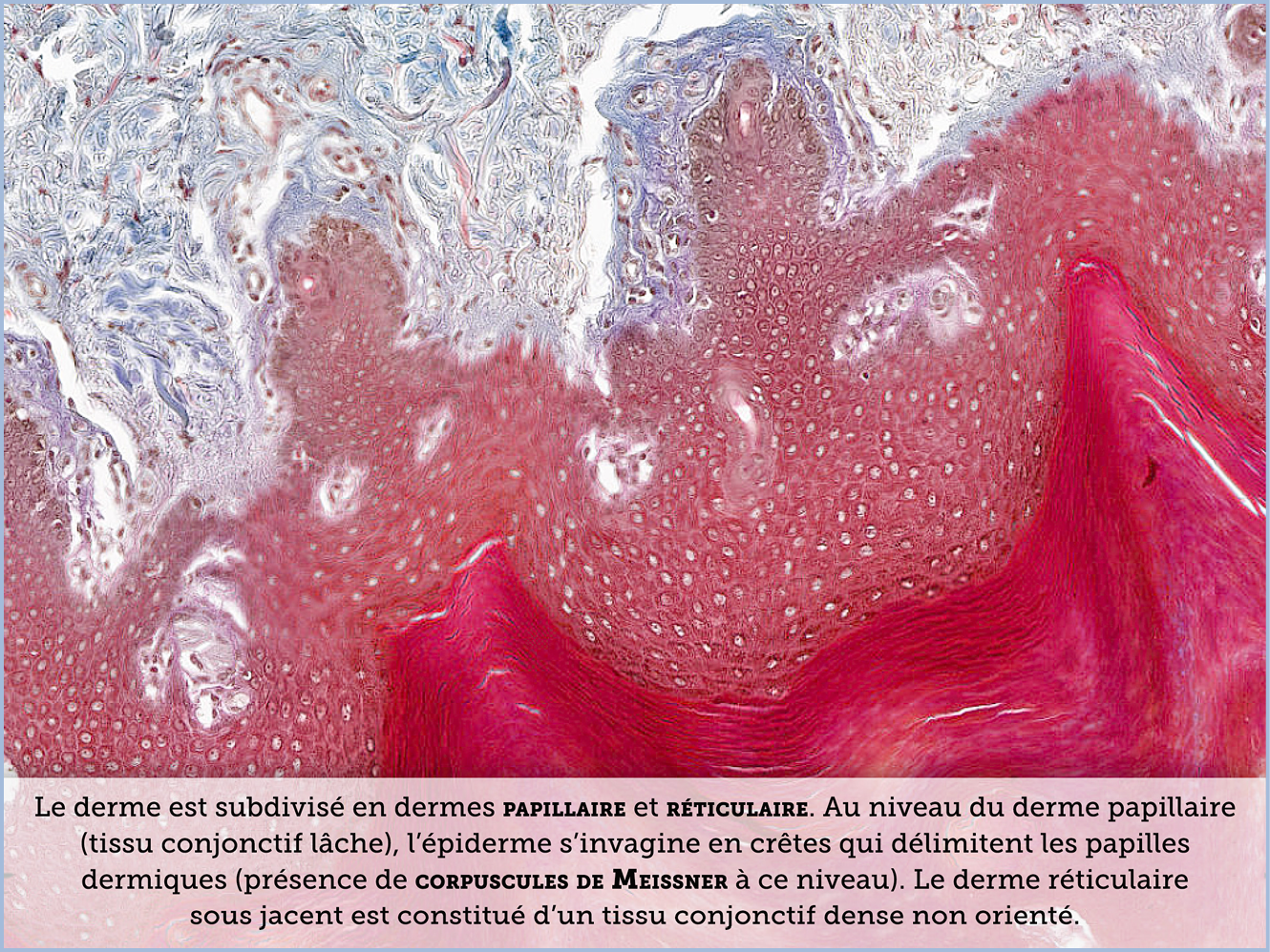 FICHE 2 TUMEUR WARTHIN ECRAN C