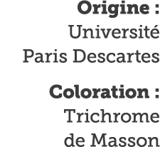 Origine : Universit  Paris Descartes Coloration : Trichrome de Masson