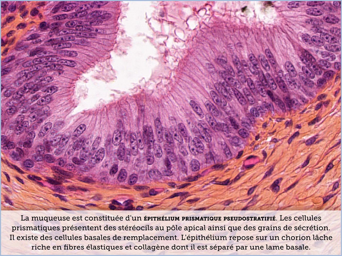 FICHE 2 TUMEUR WARTHIN ECRAN C