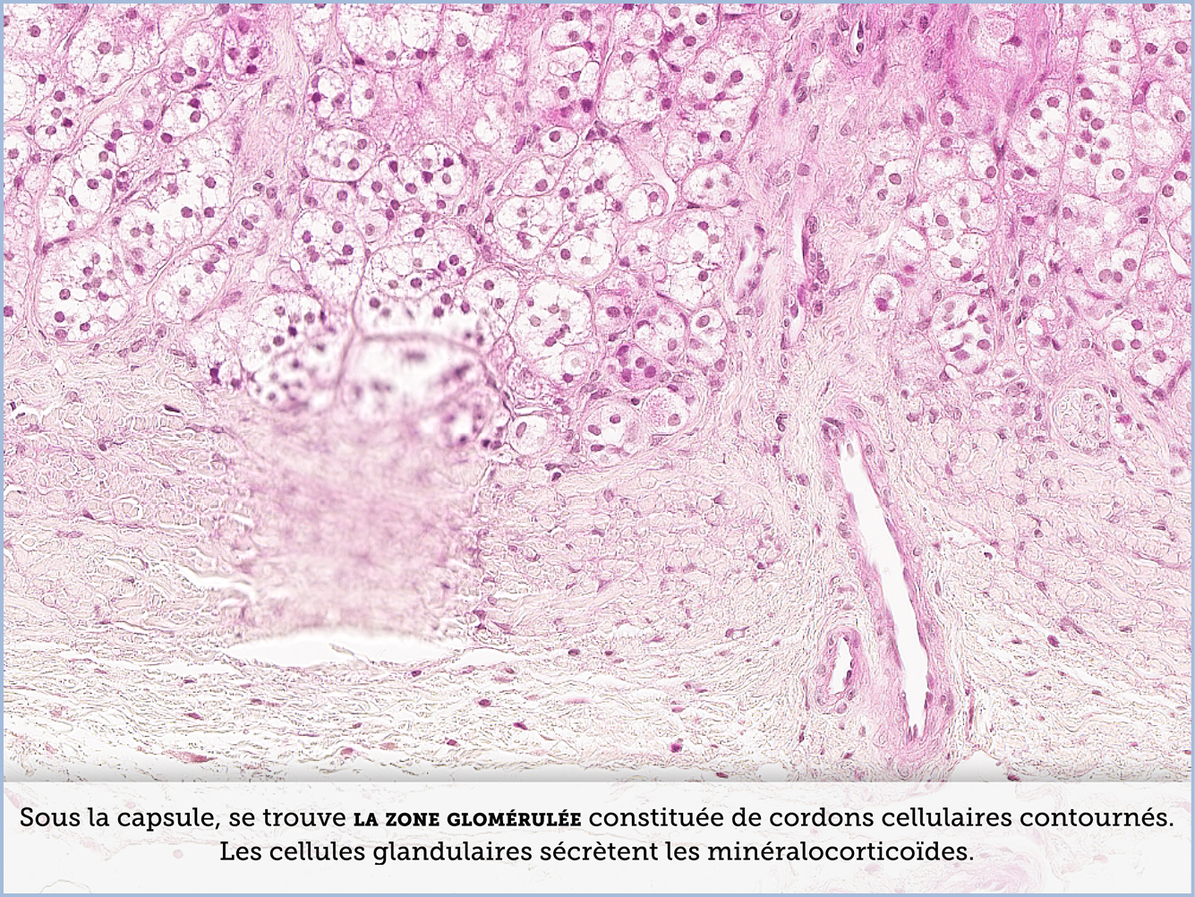 FICHE 2 TUMEUR WARTHIN VIDEO