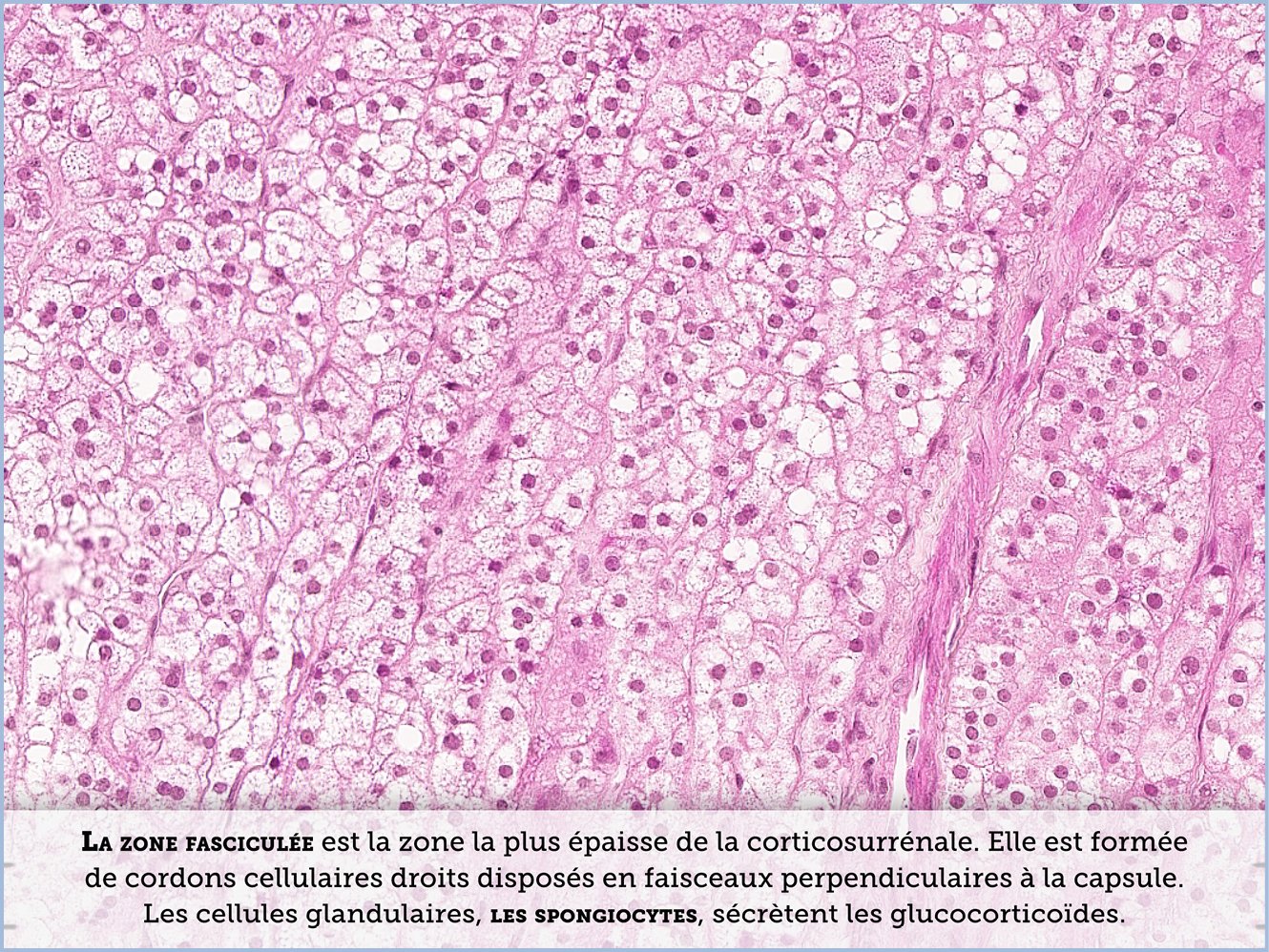 FICHE 2 TUMEUR WARTHIN ECRAN C