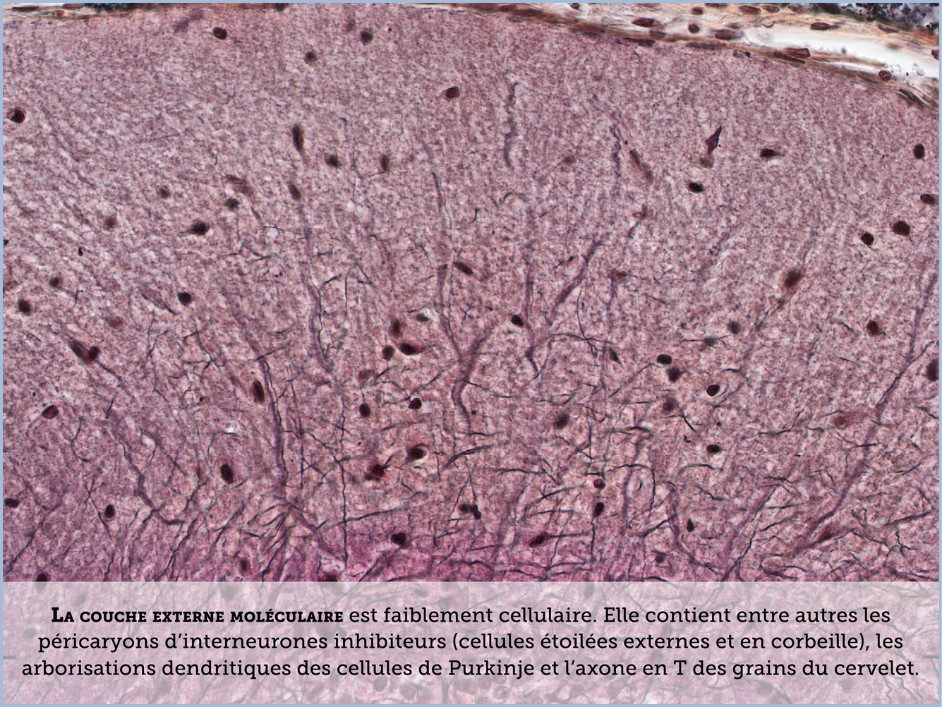 FICHE 2 TUMEUR WARTHIN VIDEO