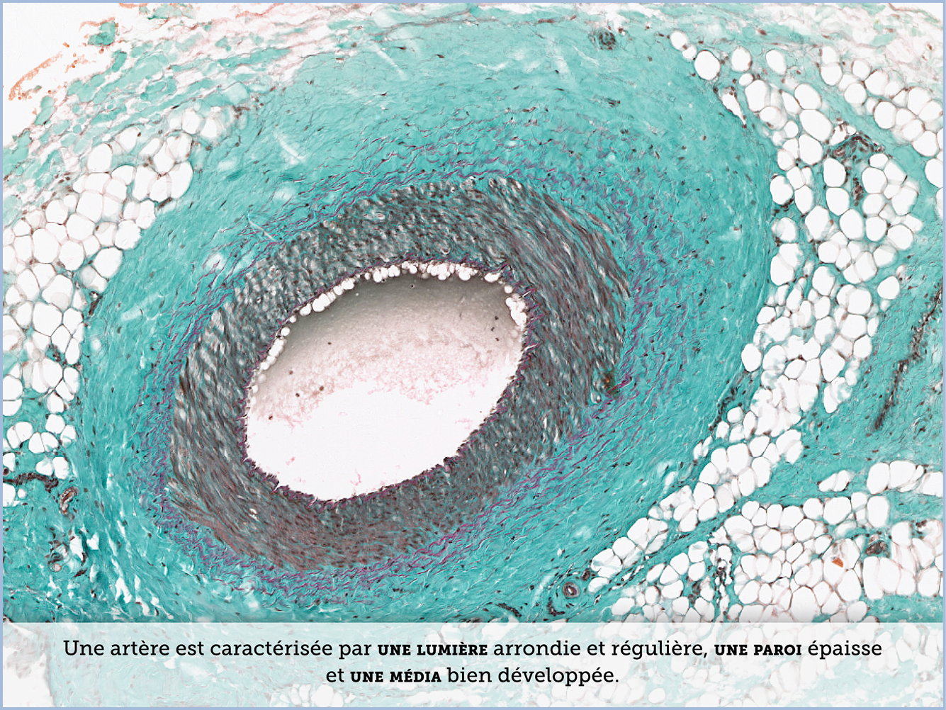 FICHE 2 TUMEUR WARTHIN VIDEO