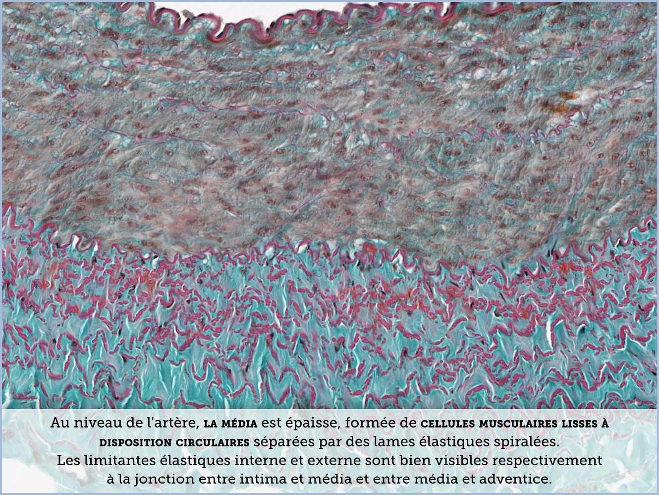 FICHE 2 TUMEUR WARTHIN ECRAN B
