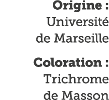 Origine : Universit  de Marseille Coloration : Trichrome de Masson