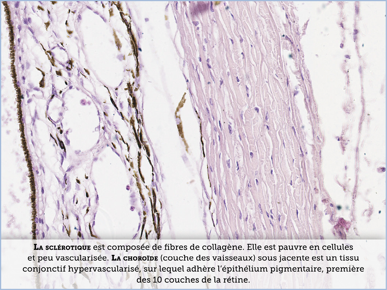 FICHE 2 TUMEUR WARTHIN VIDEO