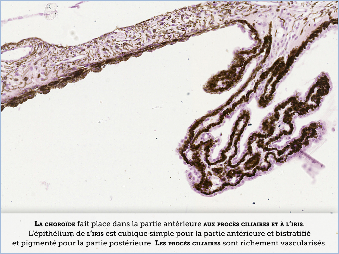 FICHE 2 TUMEUR WARTHIN ECRAN B