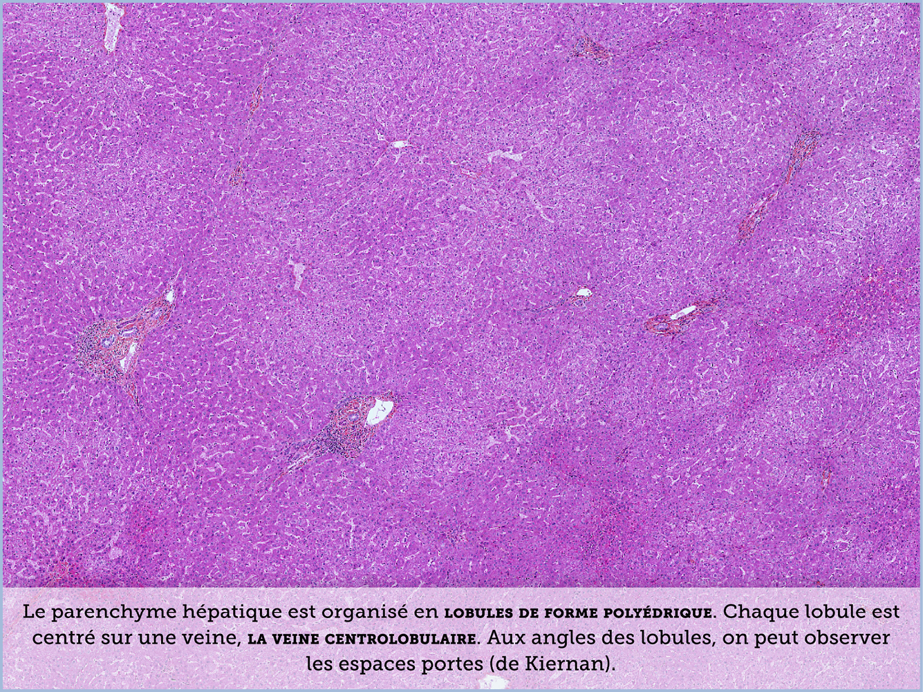 FICHE 2 TUMEUR WARTHIN VIDEO