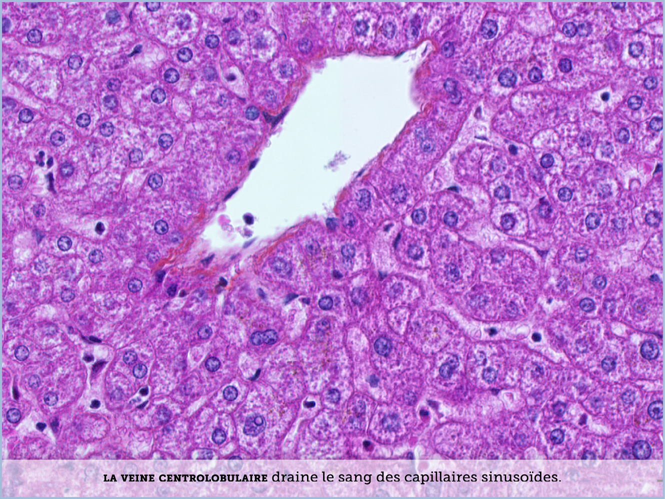 FICHE 2 TUMEUR WARTHIN ECRAN C