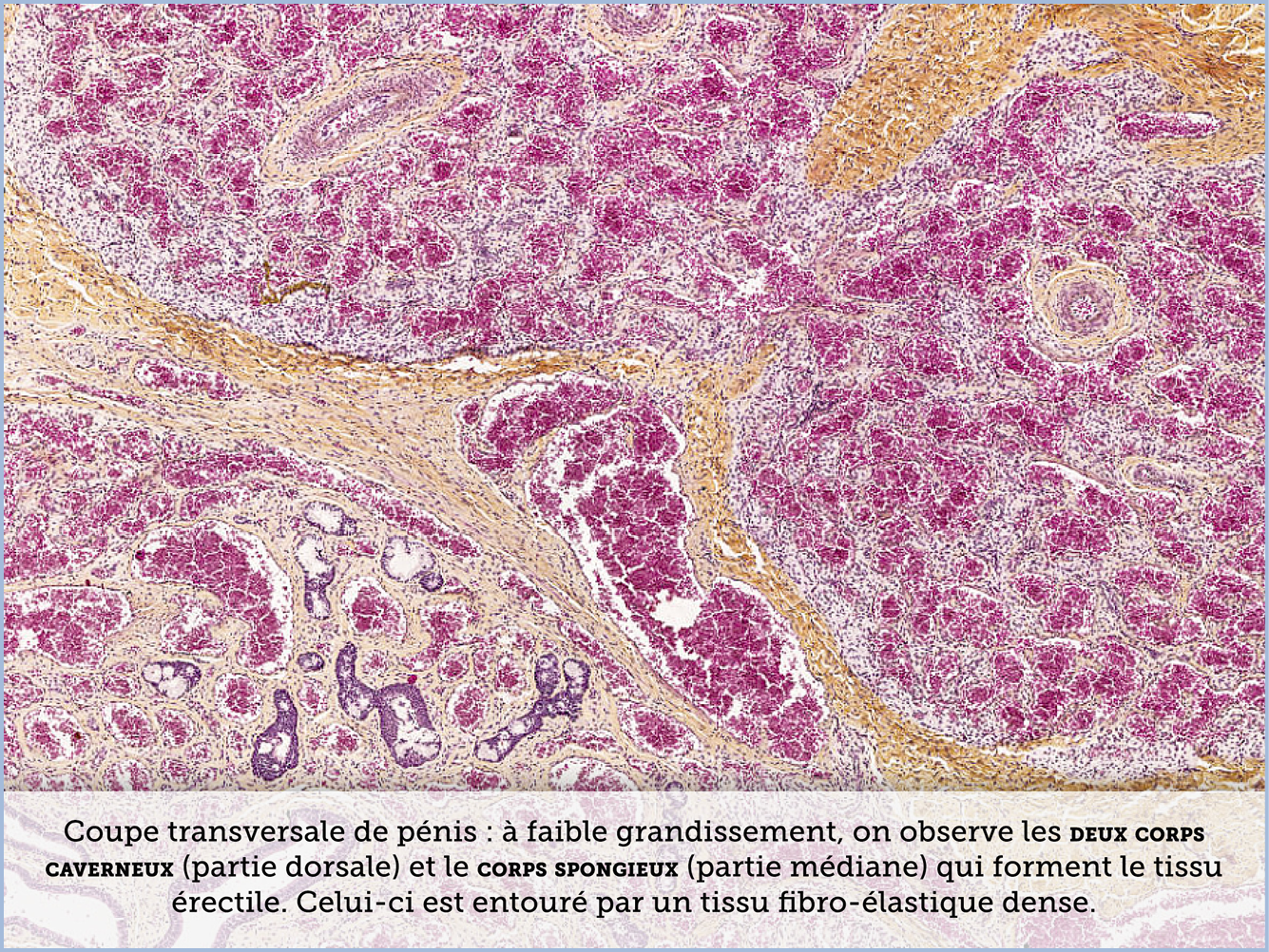 FICHE 2 TUMEUR WARTHIN VIDEO