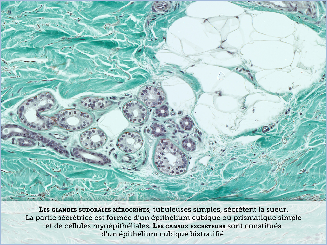 FICHE 2 TUMEUR WARTHIN ECRAN A