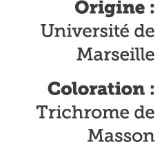 Origine : Universit  de Marseille Coloration : Trichrome de Masson