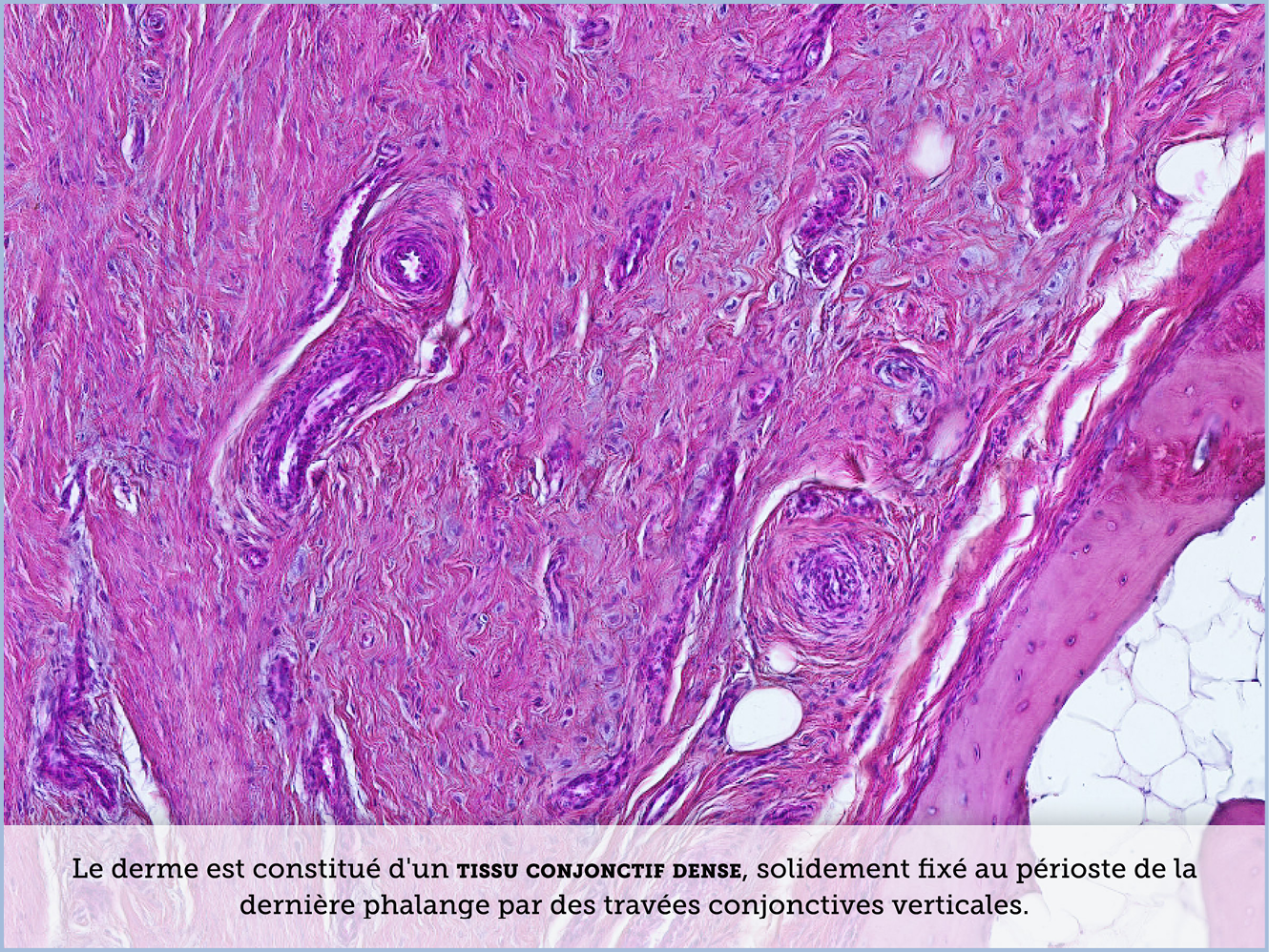 FICHE 2 TUMEUR WARTHIN ECRAN A