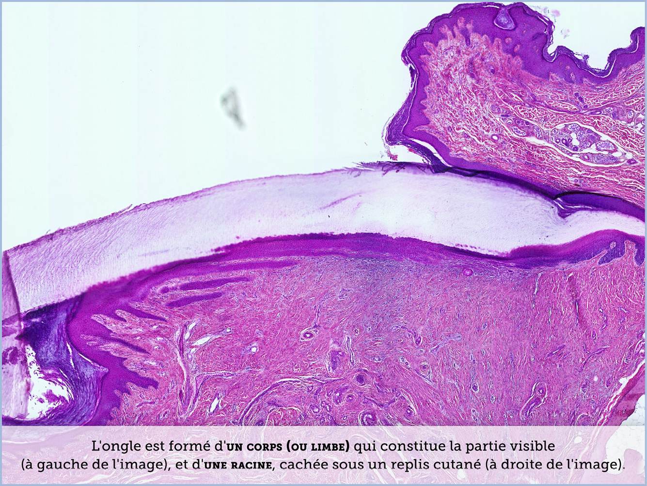 FICHE 2 TUMEUR WARTHIN VIDEO