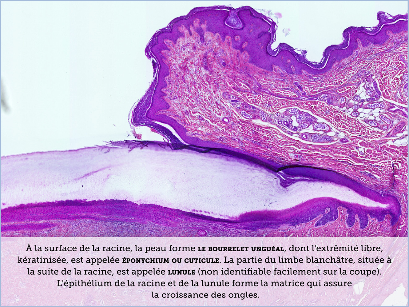 FICHE 2 TUMEUR WARTHIN ECRAN C