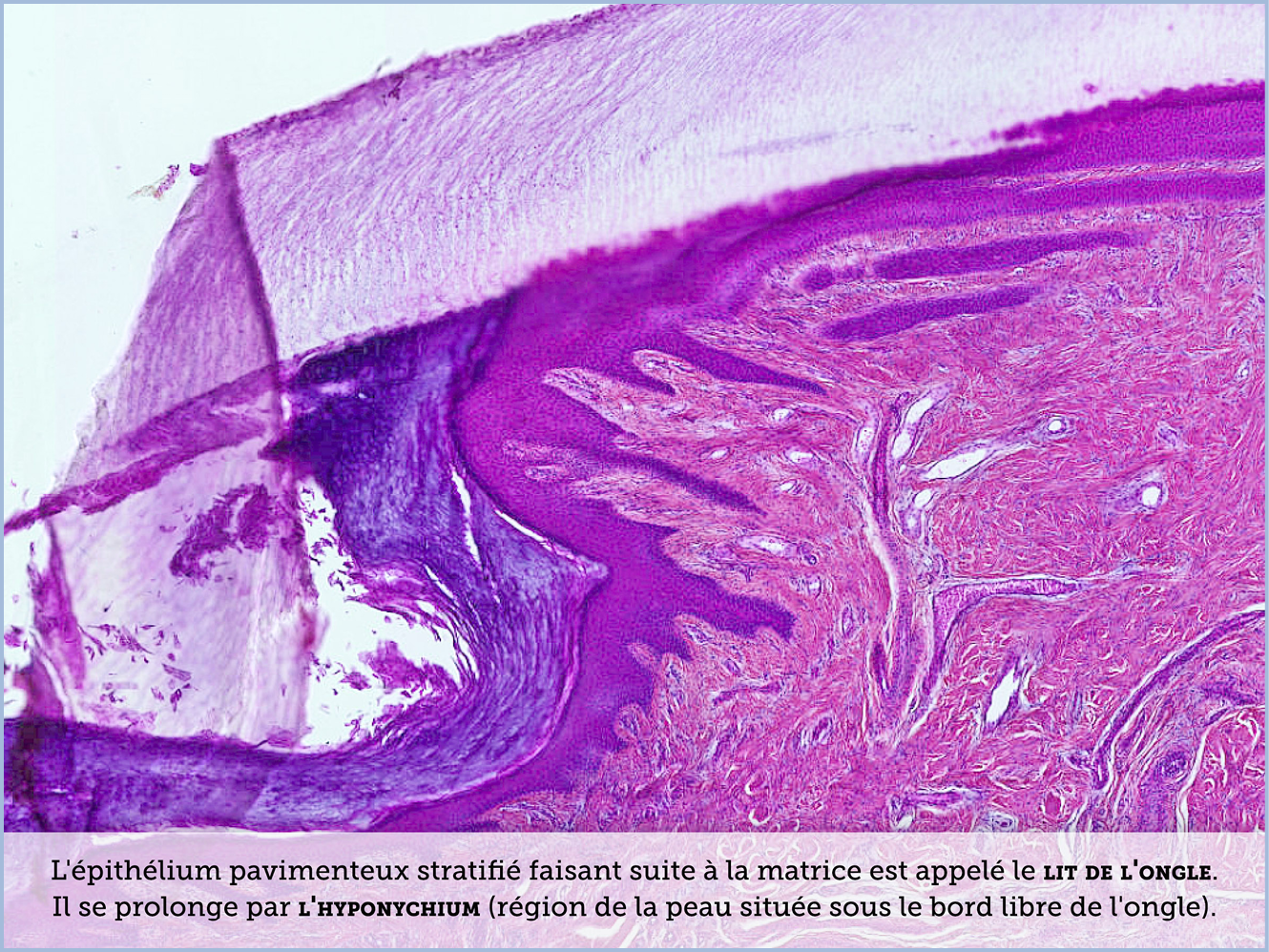 FICHE 2 TUMEUR WARTHIN ECRAN B