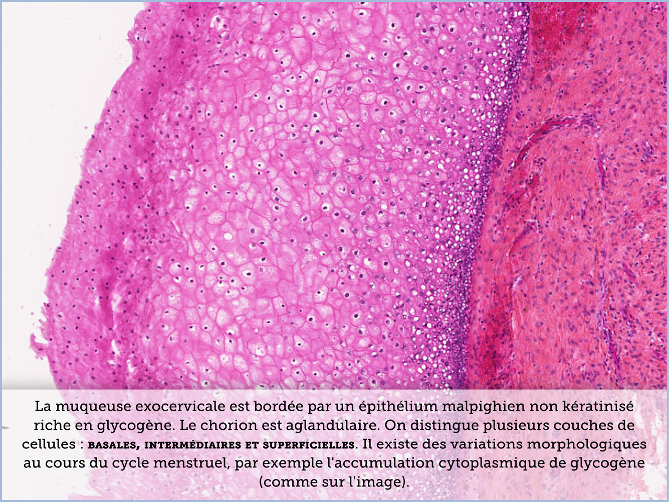 FICHE 2 TUMEUR WARTHIN VIDEO
