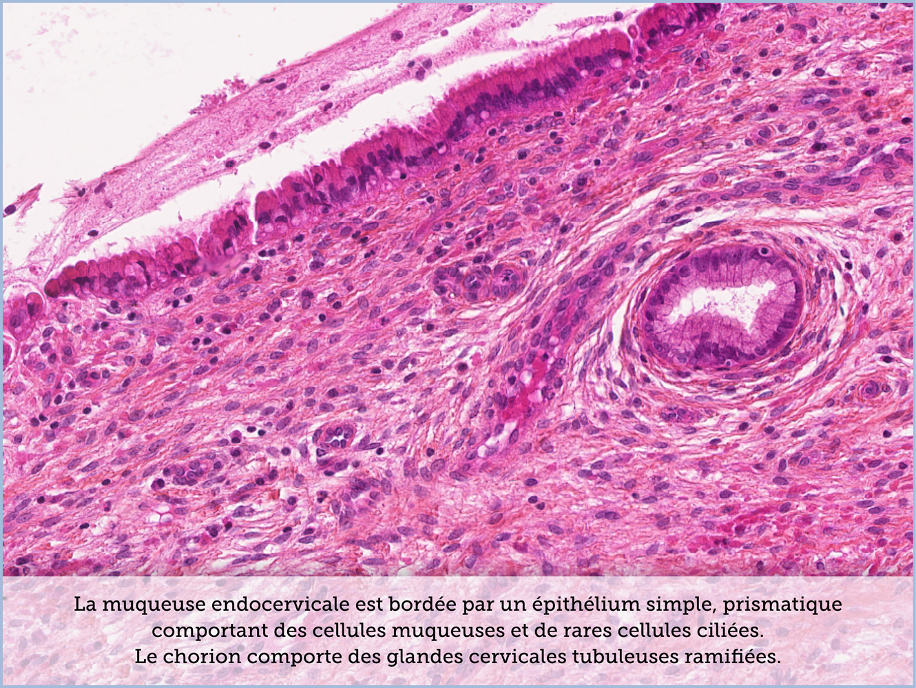 FICHE 2 TUMEUR WARTHIN ECRAN C