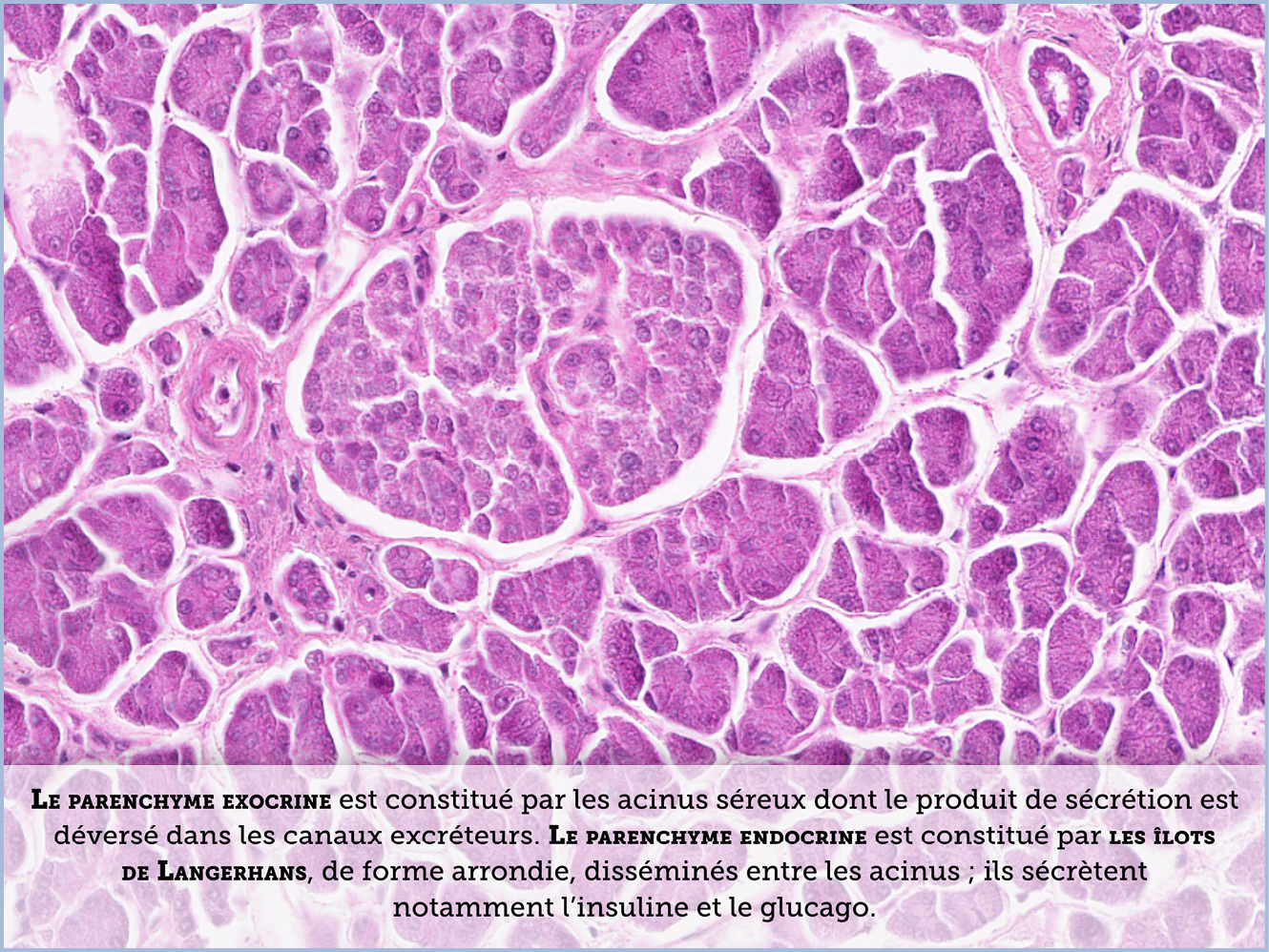 FICHE 2 TUMEUR WARTHIN ECRAN C