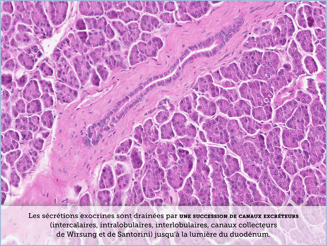 FICHE 2 TUMEUR WARTHIN ECRAN A