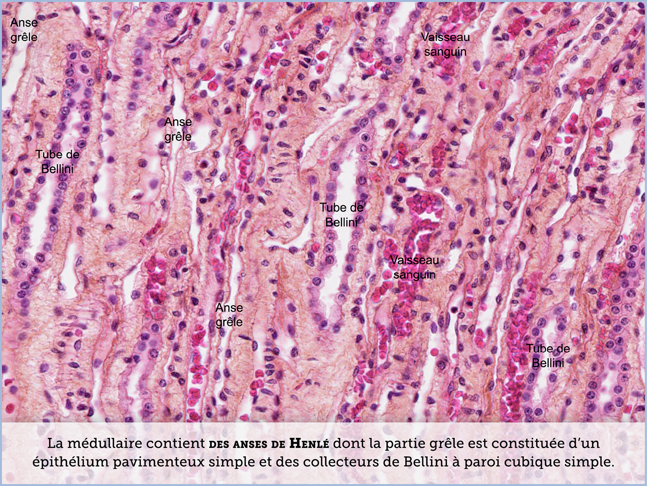 FICHE 2 TUMEUR WARTHIN ECRAN B
