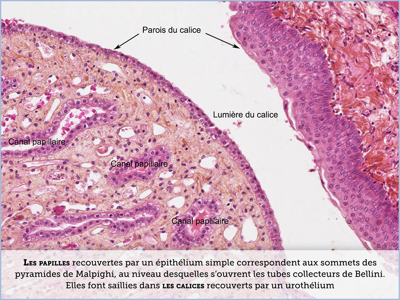 FICHE 2 TUMEUR WARTHIN ECRAN A