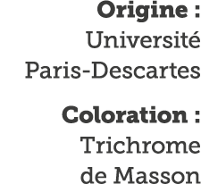 Origine : Universit  Paris-Descartes Coloration : Trichrome de Masson
