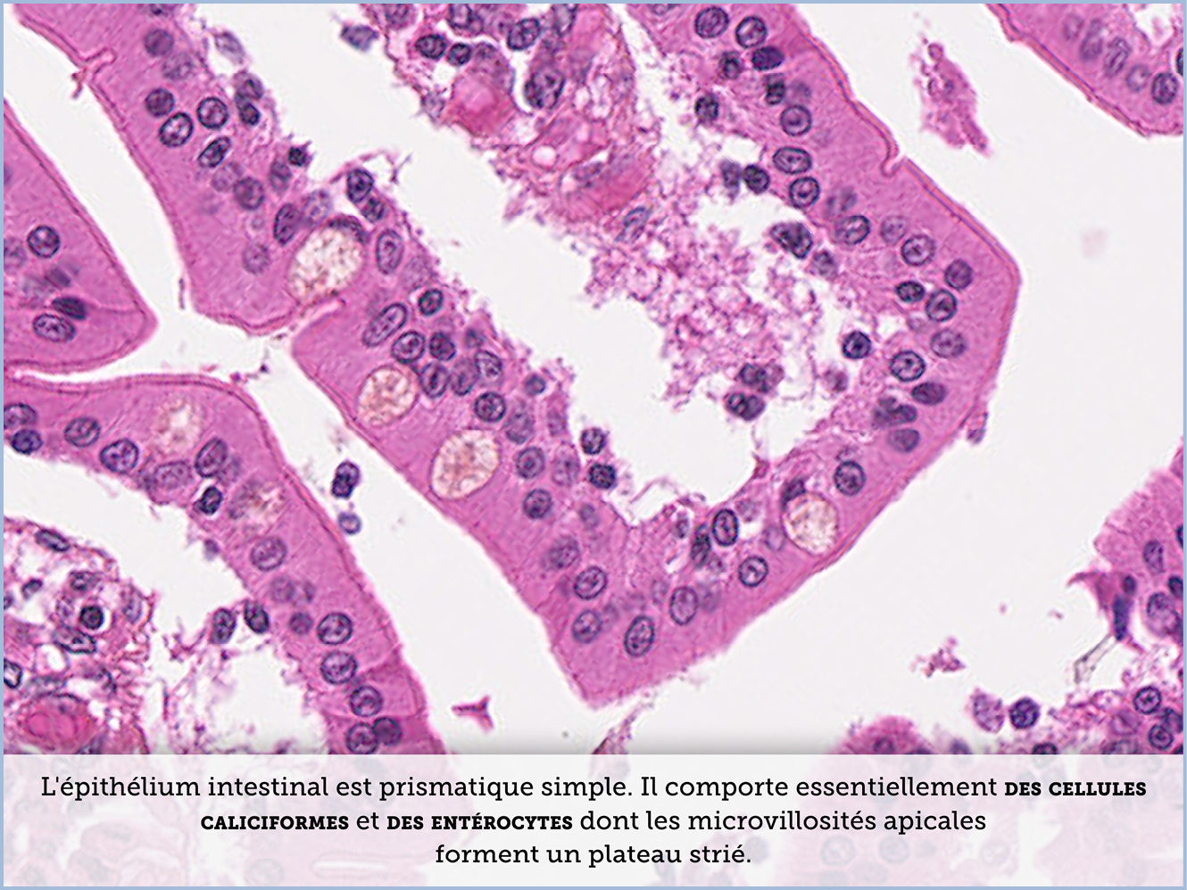 FICHE 2 TUMEUR WARTHIN ECRAN B