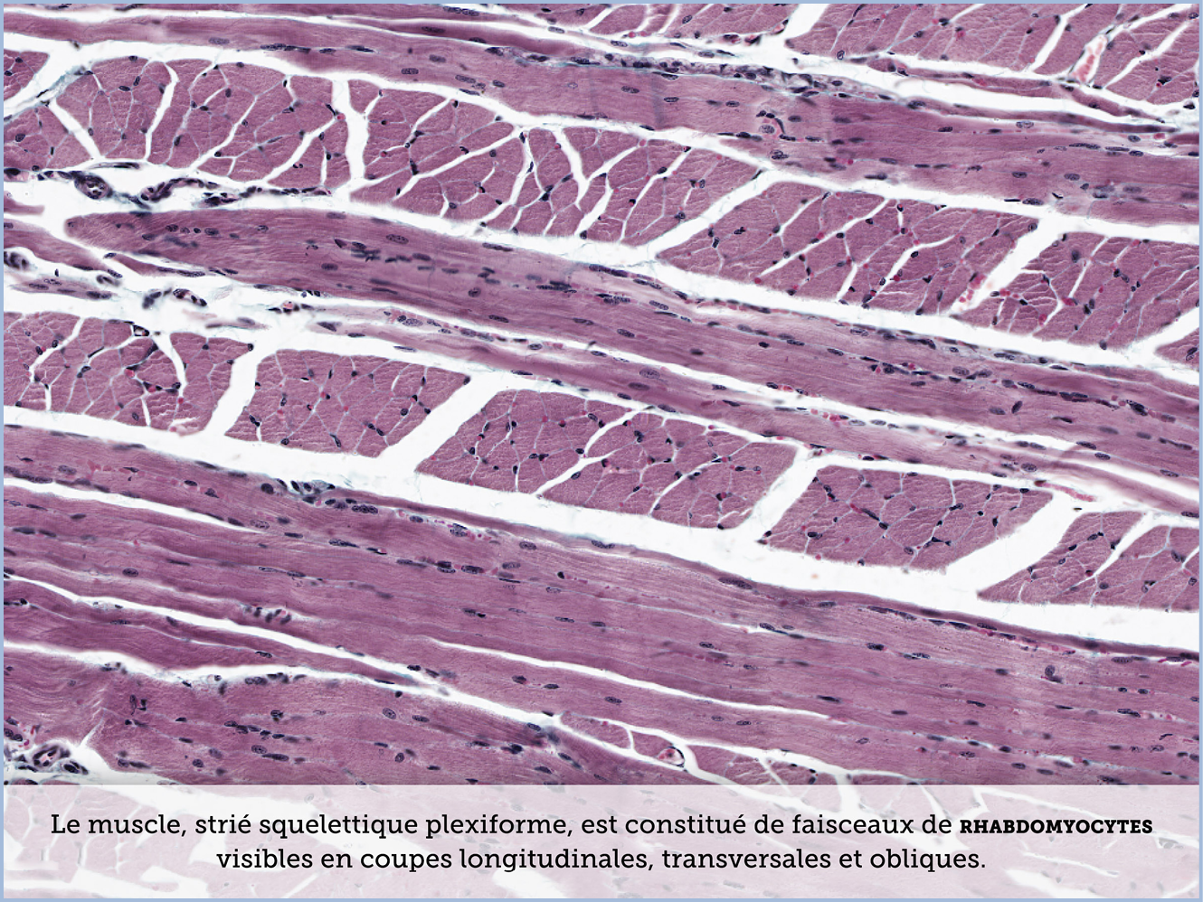 FICHE 2 TUMEUR WARTHIN ECRAN B