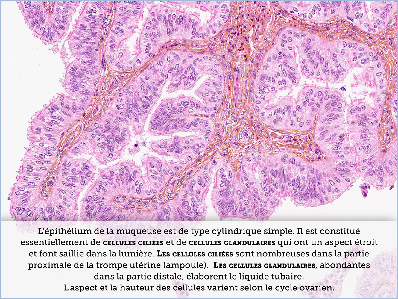 FICHE 2 TUMEUR WARTHIN ECRAN C
