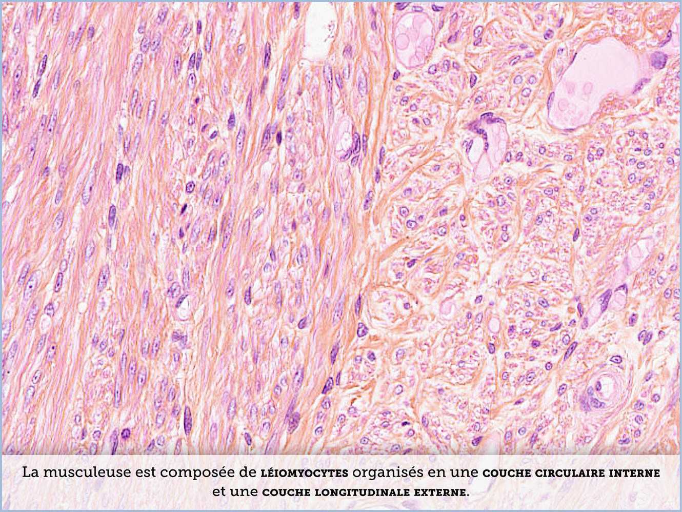 FICHE 2 TUMEUR WARTHIN ECRAN B