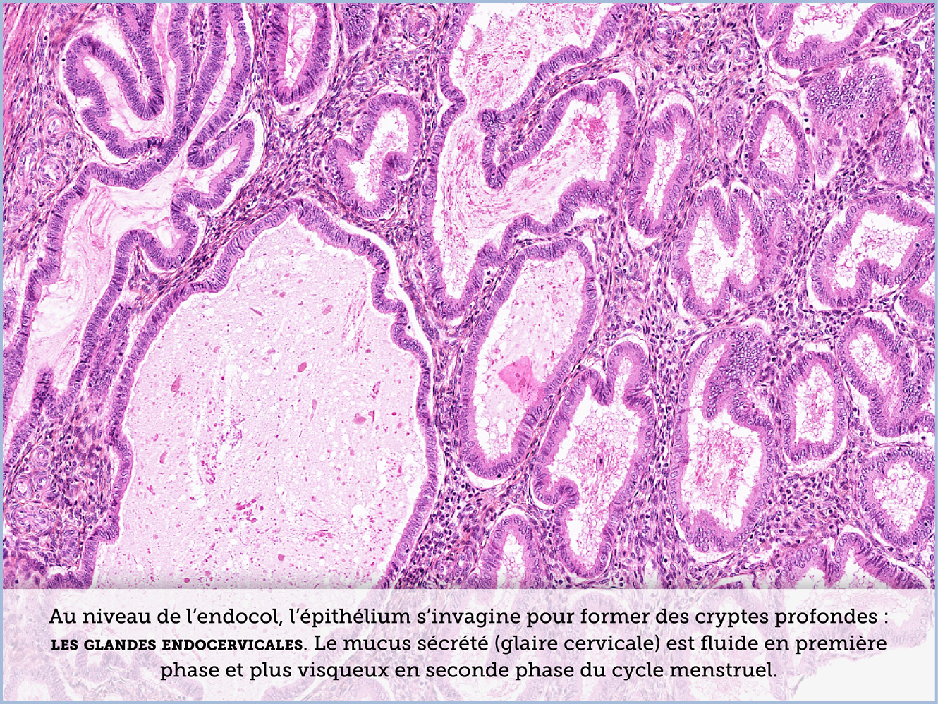 FICHE 2 TUMEUR WARTHIN ECRAN C