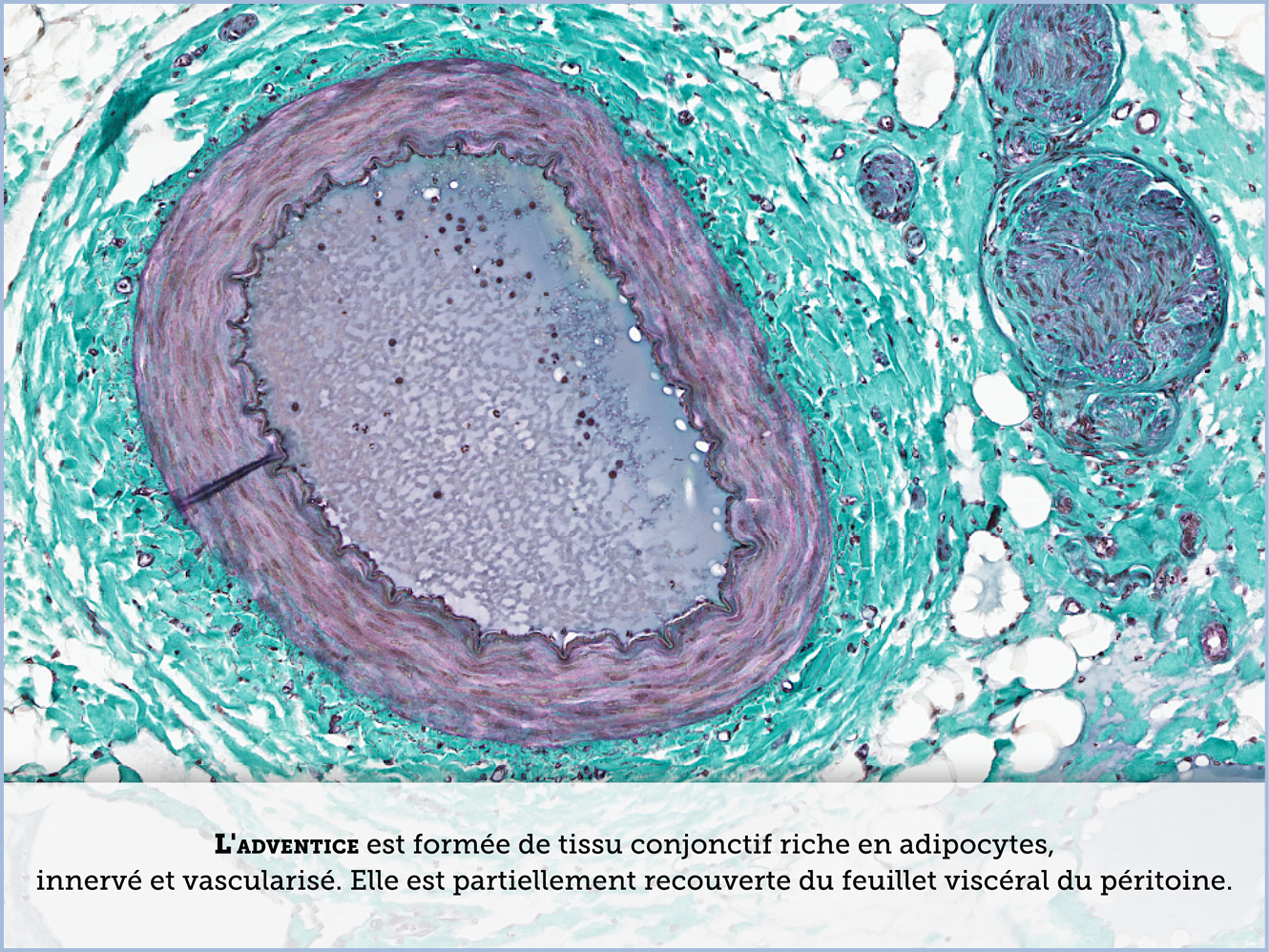 FICHE 2 TUMEUR WARTHIN ECRAN B