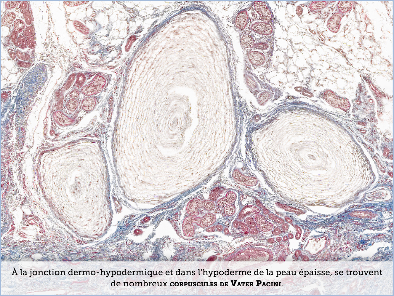 FICHE 2 TUMEUR WARTHIN ECRAN A