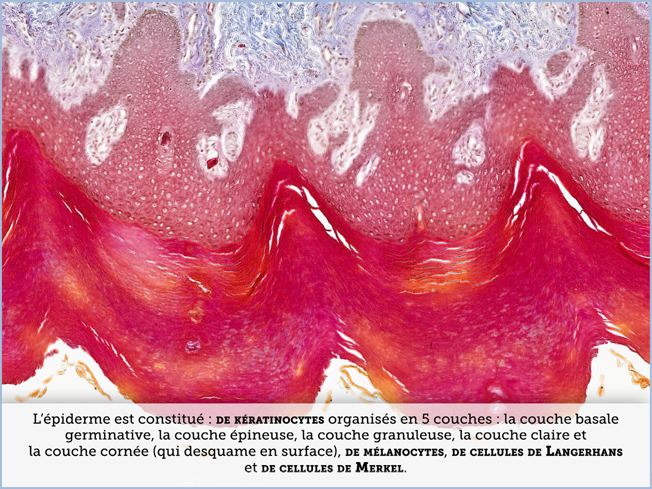 FICHE 2 TUMEUR WARTHIN VIDEO