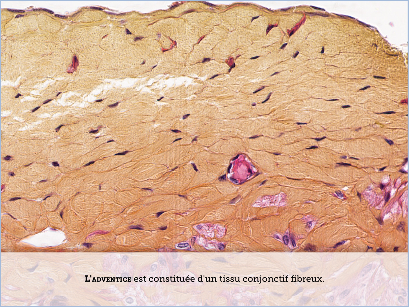 FICHE 2 TUMEUR WARTHIN ECRAN A