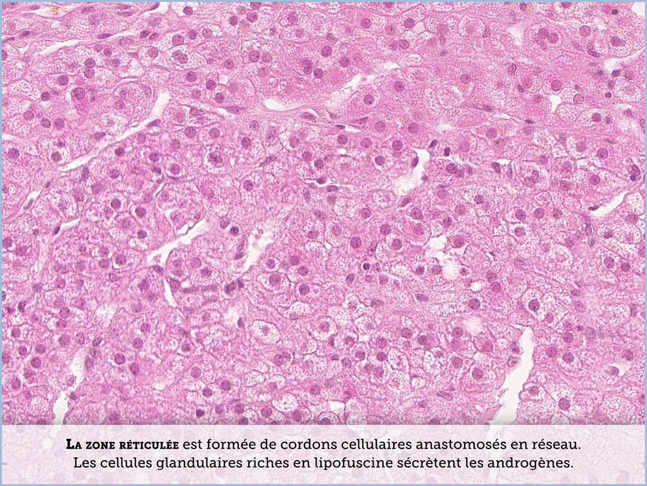 FICHE 2 TUMEUR WARTHIN ECRAN B